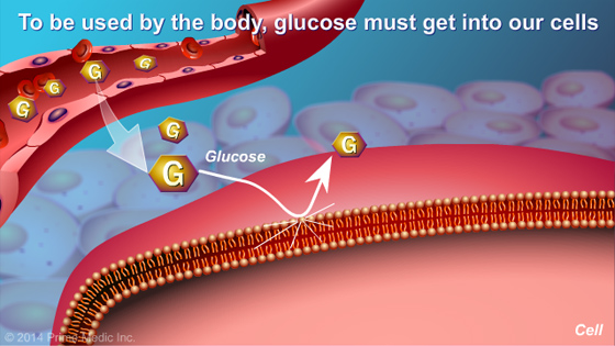 Understanding Type 2 Diabetes - Slide Show - 6