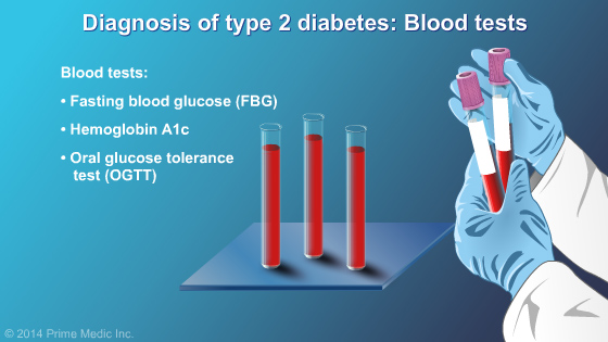 Diagnosis of Type 2 Diabetes - Slide Show - 4