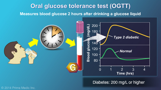 Diagnosis of Type 2 Diabetes - Slide Show - 7