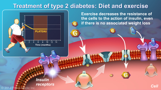 Management and Treatment of Type 2 Diabetes - Slide Show - 6