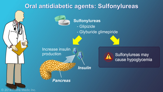 Management and Treatment of Type 2 Diabetes - Slide Show - 11