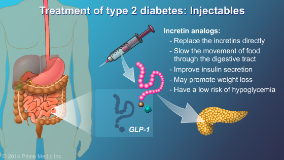 Management and Treatment of Type 2 Diabetes - Slide Show - 16