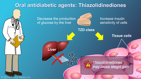 Management and Treatment of Type 2 Diabetes - Slide Show - 17