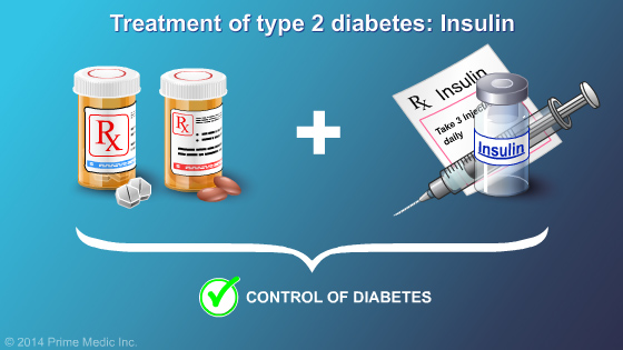 Management and Treatment of Type 2 Diabetes - Slide Show - 20