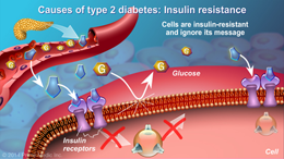 Understanding Type 2 Diabetes - Slide Show